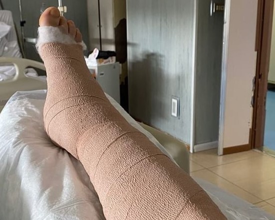AUGURI GIANLUCA DELIGIA!/ Operato oggi lo sfortunato giocatore del Samugheo che aveva riportato la frattura della tibia e del perone